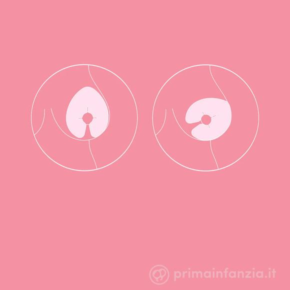 Impacchi per il Seno Caldo-Freddo - Hot-Cold Breast Relief Packs Frida Mom